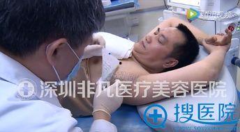 狐臭手术视频,专业视频带你了解祛除狐臭的奥秘